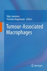 Tumour-Associated Macrophages - 