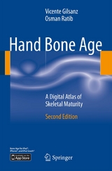 Hand Bone Age - Vicente Gilsanz, Osman Ratib