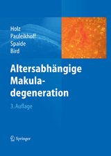 Altersabhängige Makuladegeneration -  Frank G. Holz,  Daniel Pauleikhoff,  Richard F. Spaide,  Alan C. Bird