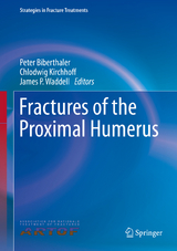 Fractures of the Proximal Humerus - 
