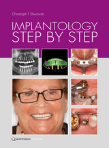 Implantology Step by Step - Christoph T. Sliwowski, Stefan Hummeke, Dominika Sliwowska, Christian F. J. Stappert