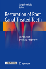 Restoration of Root Canal-Treated Teeth - 