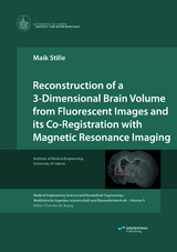Reconstruction of a 3-Dimensional Brain Volume from Fluorescent Images and its Co-Registration with Magnetic Resonance Imaging - Maik Stille