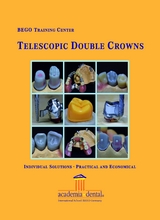 Telescopic double Crowns - Henning Wulfes