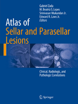 Atlas of Sellar and Parasellar Lesions - 