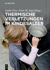 Thermische Verletzungen im Kindesalter - 