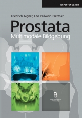 Prostata - 