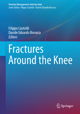 Fractures Around the Knee - 