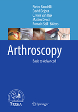 Arthroscopy - 