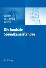 Die lumbale Spinalkanalstenose -  Robert Krämer,  Theodoros Theodoridis,  Jürgen Krämer