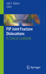 PIP Joint Fracture Dislocations - 