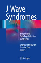 J Wave Syndromes - 