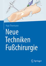 Neue Techniken Fußchirurgie - Thermann, Hajo