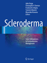 Scleroderma - Varga, John; Denton, Christopher P.; Wigley, Fredrick M.; Allanore, Yannick; Kuwana, Masataka