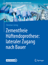 Zementfreie Hüftendoprothese: lateraler Zugang nach Bauer - Christian Lüring