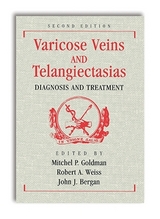 Varicose Veins and Telangiectasias: Diagnosis and Treatment, Second Edition - Goldman, Mitchel P.; Weiss, Robert; Bergan, John
