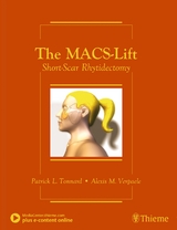 The MACS-Lift - Tonnard, Patrick; Verpaele, Alexis