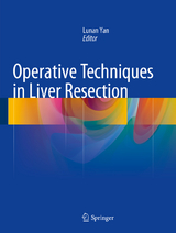 Operative Techniques in Liver Resection - 