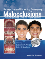 Recognizing and Correcting Developing Malocclusions - 