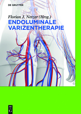 Endoluminale Varizentherapie -  Florian Johannes Netzer