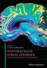 Posttraumatic Stress Disorder -  J. Douglas Bremner