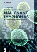 Malignant Lymphomas - 