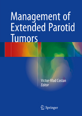 Management of Extended Parotid Tumors - 