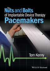 The Nuts and Bolts of Implantable Device Therapy - Tom Kenny