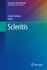 Scleritis - 