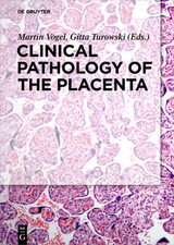 Clinical Pathology of the Placenta - 