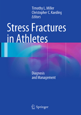 Stress Fractures in Athletes - 