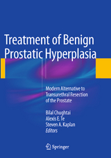 Treatment of Benign Prostatic Hyperplasia: Modern Alternative to Transurethral Resection of the Prostate - 