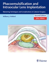 Phacoemulsification and Intraocular Lens Implantation - Fishkind, William J.
