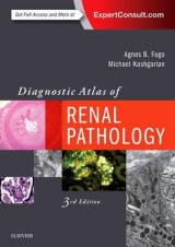 Diagnostic Atlas of Renal Pathology - Fogo, Agnes B.; Kashgarian, Michael