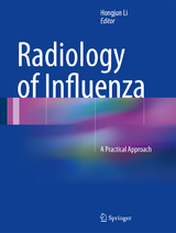 Radiology of Influenza - 