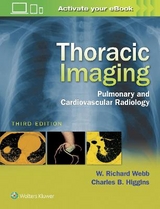 Thoracic Imaging - Webb, W. Richard; Higgins, Charles B.