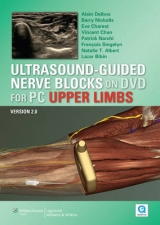Ultrasound-guided Nerve Blocks on DVD Vs 2.0: Upper Limbs for PC - Delbos, Alain