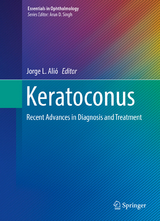 Keratoconus - 