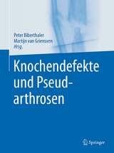 Knochendefekte und Pseudarthrosen -  Peter Biberthaler,  Martijn van Griensven,  Patrick Delhey