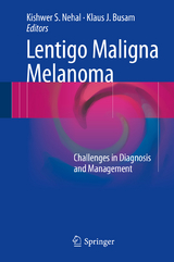 Lentigo Maligna Melanoma - 