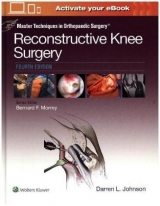 Master Techniques in Orthopaedic Surgery: Reconstructive Knee Surgery - Johnson, Dr. Darren L.
