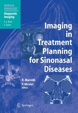Imaging in Treatment Planning for Sinonasal Diseases - 