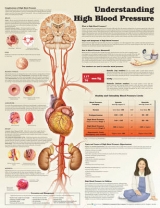 Understanding High Blood Pressure - Anatomical Chart Company