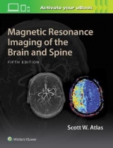 Magnetic Resonance Imaging of the Brain and Spine - Atlas, Scott W.