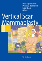 Vertical Scar Mammaplasty - 