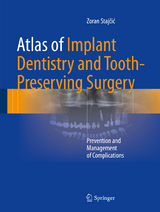 Atlas of Implant Dentistry and Tooth-Preserving Surgery -  Zoran Stajčić