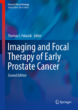 Imaging and Focal Therapy of Early Prostate Cancer - 