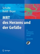 MRT des Herzens und der Gefäße -  B. Schulte,  A. Boldt,  D. Beyer