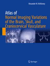 Atlas of Normal Imaging Variations of the Brain, Skull, and Craniocervical Vasculature -  Alexander M. McKinney