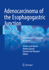 Adenocarcinoma of the Esophagogastric Junction - 